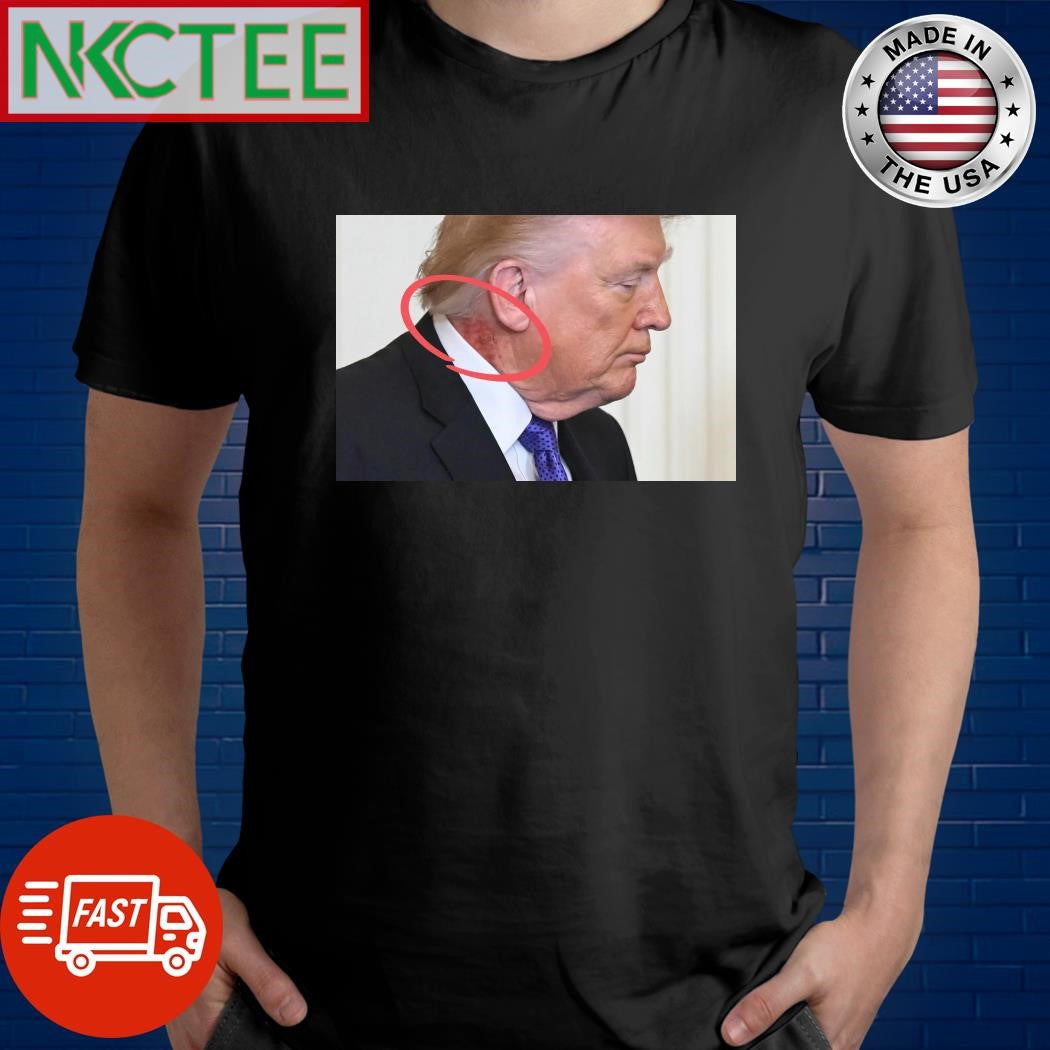 Large red mark on the neck of US President Donald Trump tee
